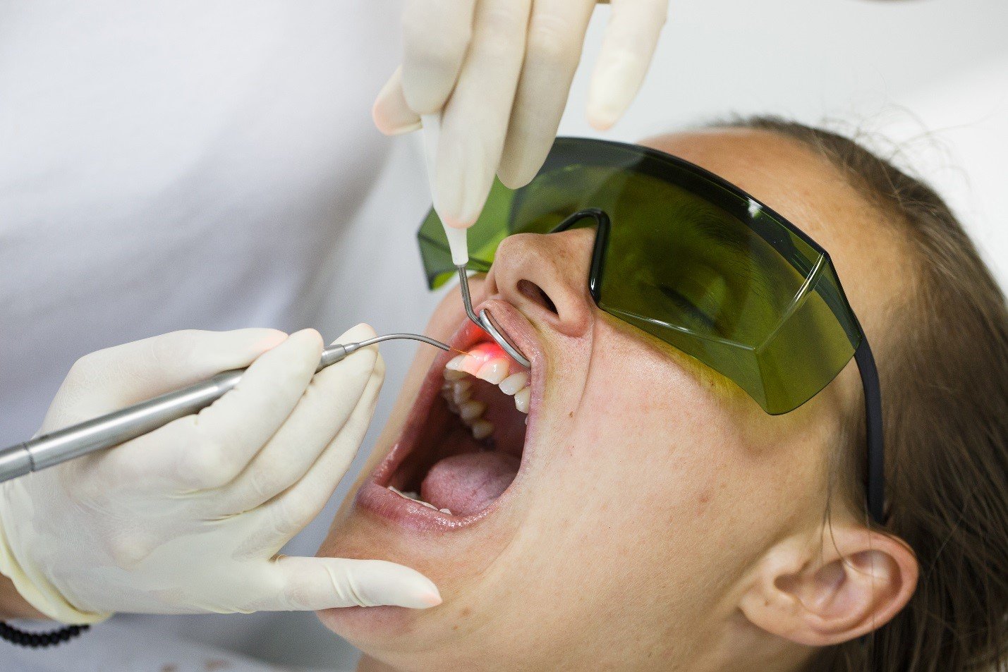 Gum Surgery in Ahmedabad